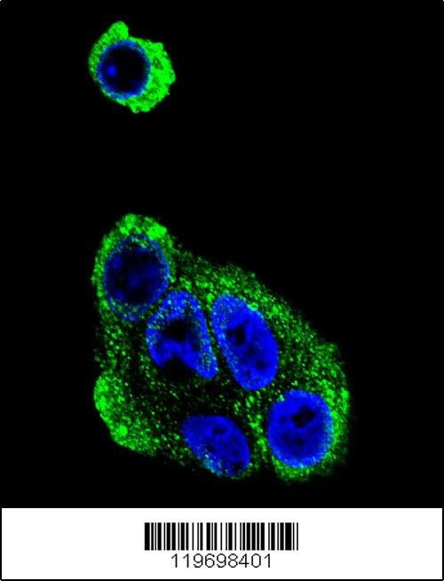 ADH1B Antibody