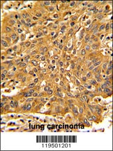 FSCN1 Antibody