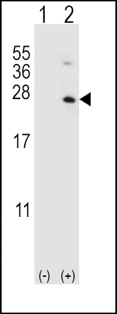 HPRT1 Antibody