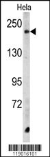 CPD Antibody