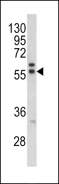 PRAME Antibody