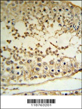 MAPE Antibody