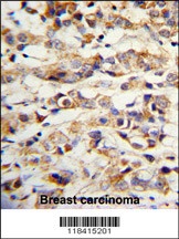 KRT14 Antibody