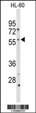 CYP2C19 Antibody