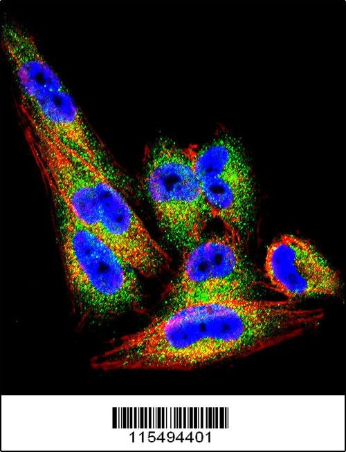 TIMP1 Antibody
