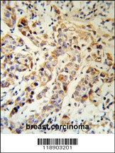 KRT13 Antibody