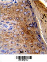 KRT10 Antibody