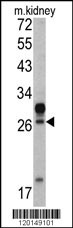 HOXA5 Antibody
