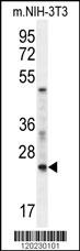 RAN Antibody