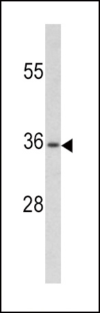 PAX4 Antibody