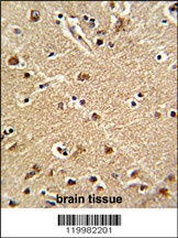 ZWINT Antibody