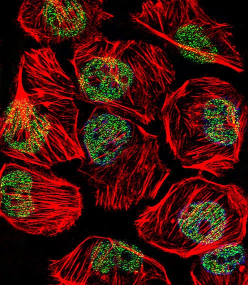 TBP Antibody