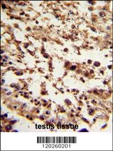 TBP Antibody
