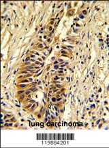 TALDO1 Antibody