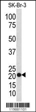 TAGLN Antibody