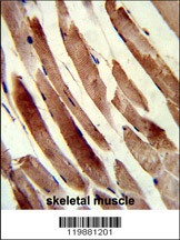 TAGLN Antibody