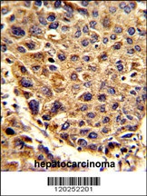 SPCS3 Antibody