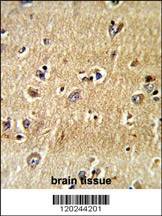 SCFD1 Antibody