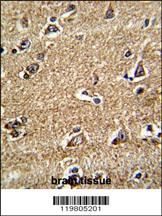 RAB13 Antibody