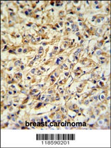 PRELP Antibody