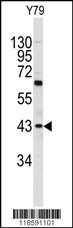 PRELP Antibody