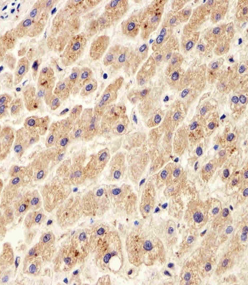 PDIA6 Antibody