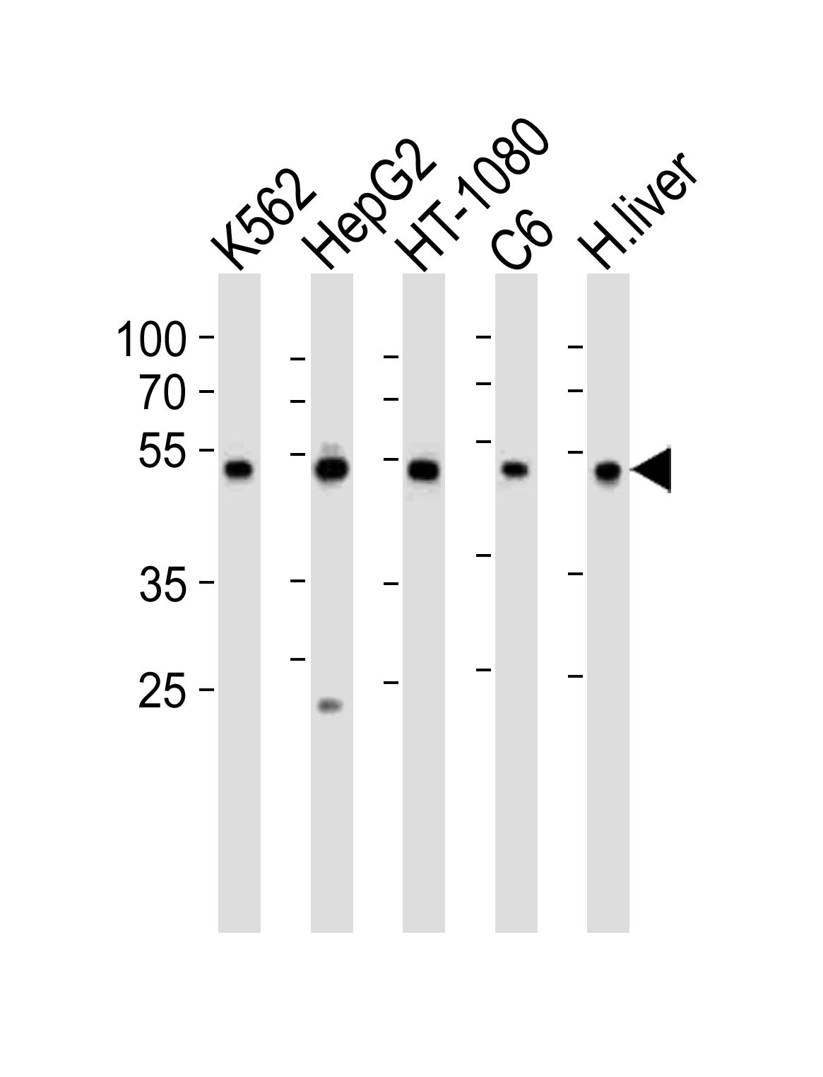 PDIA6 Antibody