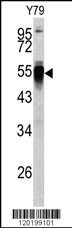 PDIA6 Antibody