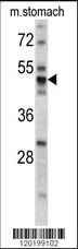 PDIA6 Antibody