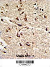 PDIA6 Antibody