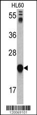 GLO1 Antibody