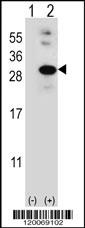 GLO1 Antibody