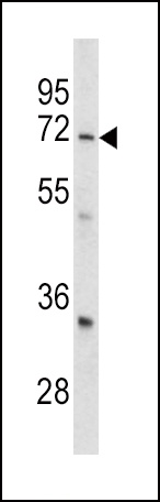 GARP Antibody
