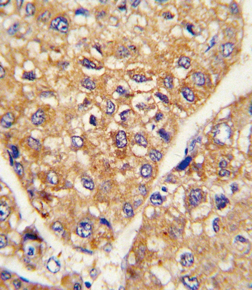 GARP Antibody