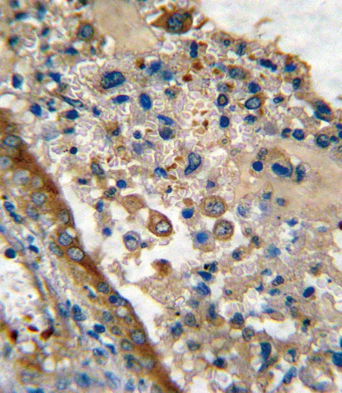 GARP Antibody