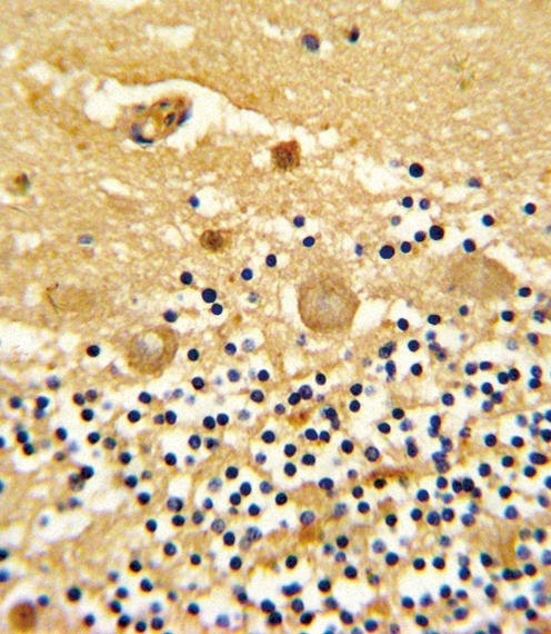 GARP Antibody