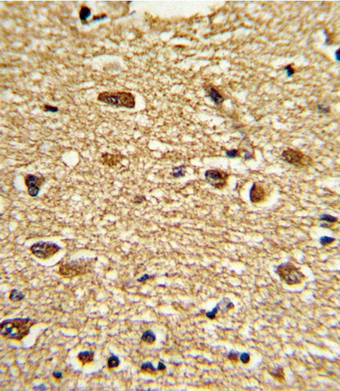 ETV4 Antibody