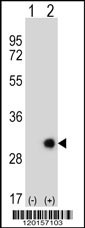 ETHE1 Antibody