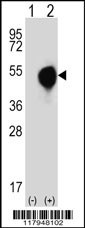 DXO Antibody