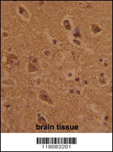 CTDP1 Antibody