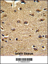 CLUAP1 Antibody