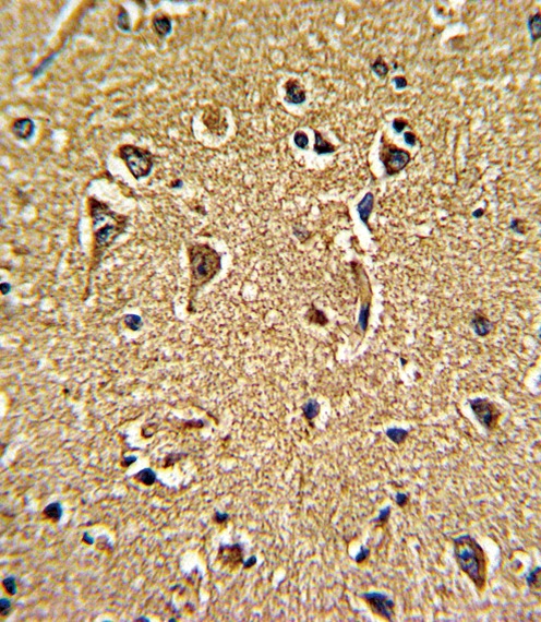 CACNG5 Antibody