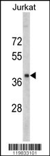 RRM2 Antibody