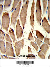 RRM2 Antibody