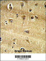 RPS9 Antibody