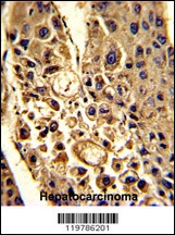 CFHR1 Antibody