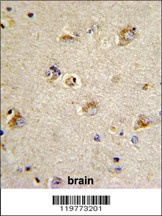 CDCA3 Antibody