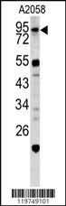 CALD1 Antibody