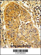 CALD1 Antibody
