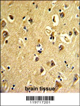 ARPC3 Antibody